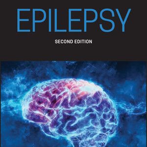 Epilepsy 2nd Edition – PDF ebook