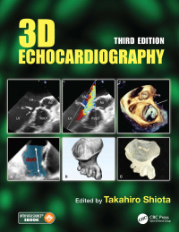 3D Echocardiography 3rd Edition – PDF ebook
