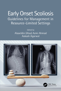 Early Onset Scoliosis: Guidelines for Management in Resource-Limited Settings 1st Edition – PDF ebook