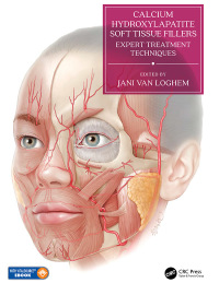 Calcium Hydroxylapatite Soft Tissue Fillers: Expert Treatment Techniques 1st Edition – PDF ebook
