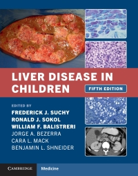 Liver Disease in Children 1st Edition – PDF ebook