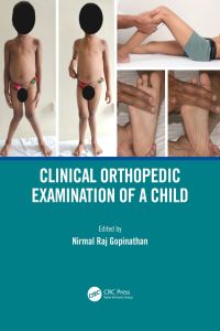 Clinical Orthopedic Examination of a Child 1st Edition – PDF ebook