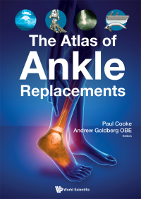 Atlas Of Ankle Replacements, The 1st Edition – PDF ebook