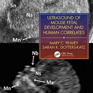 Ultrasound of Mouse Fetal Development and Human Correlates – PDF ebook