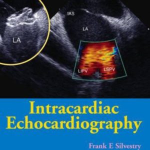Intracardiac Echocardiography – PDF ebook
