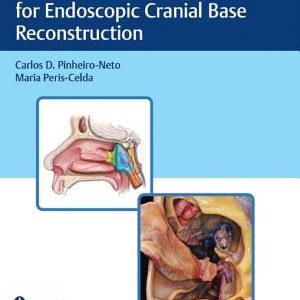 Techniques and Key Points for Endoscopic Cranial Base Reconstruction – PDF ebook