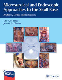 Microsurgical and Endoscopic Approaches to the Skull Base: Anatomy, Tactics, and Techniques – PDF ebook