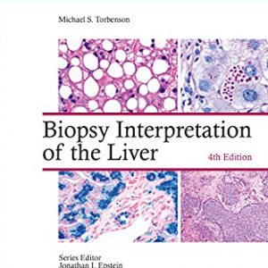 Biopsy Interpretation of the Liver (Biopsy Interpretation Series), 4th Edition – PDF ebook