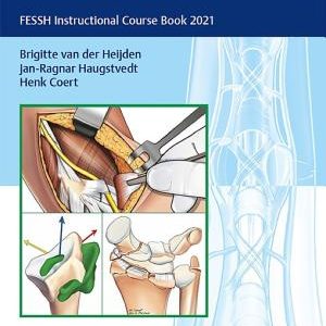 Management of Complications in Common Hand and Wrist Procedures: FESSH Instructional Course Book 2021 – PDF ebook