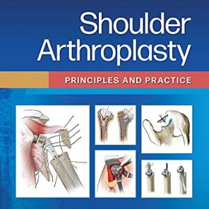 Shoulder Arthroplasty: Principles and Practice – PDF ebook