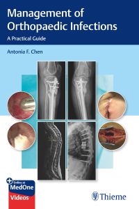 Management of Orthopaedic Infections: A Practical Guide – PDF ebook