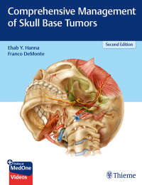 Comprehensive Management of Skull Base Tumors 2nd Edition – PDF ebook