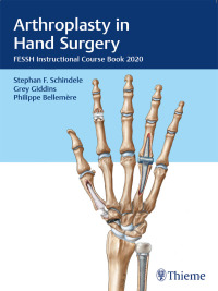 Arthroplasty in Hand Surgery: FESSH Instructional Course Book 2020 – PDF ebook