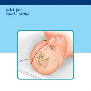 Neuro ICU Procedure Atlas – PDF ebook
