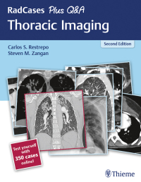 RadCases Plus Q&A Thoracic Imaging 2nd Edition – PDF ebook